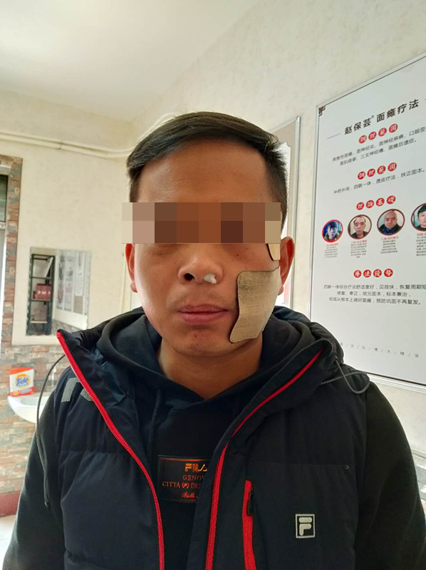 赵保芸扶正案例